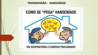 TRANSMISSÃO - HANSENÍASE
 