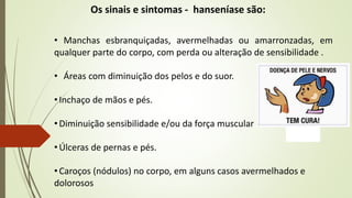 Os sinais e sintomas - hanseníase são:
• Manchas esbranquiçadas, avermelhadas ou amarronzadas, em
qualquer parte do corpo, com perda ou alteração de sensibilidade .
• Áreas com diminuição dos pelos e do suor.
• Inchaço de mãos e pés.
• Diminuição sensibilidade e/ou da força muscular
• Úlceras de pernas e pés.
• Caroços (nódulos) no corpo, em alguns casos avermelhados e
dolorosos
 