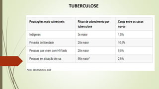 TUBERCULOSE
 