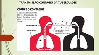 TRANSMISSÃO-CONTÁGIO DA TUBERCULOSE
 