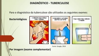 DIAGNÓSTICO - TUBERCULOSE
Para o diagnóstico da tuberculose são utilizados os seguintes exames:
Bacteriológicos
Por imagem (exame complementar)
Fonte: Google, 2019
 