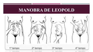 MANOBRA DE LEOPOLD
 