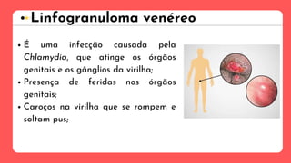 É uma infecção causada pela
Chlamydia, que atinge os órgãos
genitais e os gânglios da virilha;
Presença de feridas nos órgãos
genitais;
Caroços na virilha que se rompem e
soltam pus;
Linfogranuloma venéreo
 