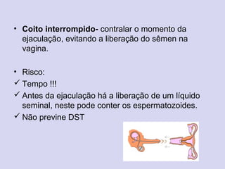 • Coito interrompido- contralar o momento da
ejaculação, evitando a liberação do sêmen na
vagina.
• Risco:
 Tempo !!!
 Antes da ejaculação há a liberação de um líquido
seminal, neste pode conter os espermatozoides.
 Não previne DST
 