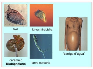 ovo larva miracídio 
caramujo 
Biomphalaria larva cercária 
“barriga d´água” 
 
