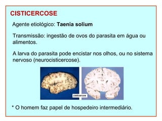 CISTICERCOSE 
Agente etiológico: Taenia solium 
Transmissão: ingestão de ovos do parasita em água ou 
alimentos. 
A larva do parasita pode encistar nos olhos, ou no sistema 
nervoso (neurocisticercose). 
* O homem faz papel de hospedeiro intermediário. 
