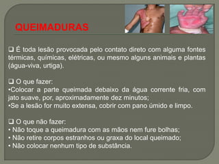 QUEIMADURAS

 É toda lesão provocada pelo contato direto com alguma fontes
térmicas, químicas, elétricas, ou mesmo alguns animais e plantas
(água-viva, urtiga).

 O que fazer:
•Colocar a parte queimada debaixo da água corrente fria, com
jato suave, por, aproximadamente dez minutos;
•Se a lesão for muito extensa, cobrir com pano úmido e limpo.

 O que não fazer:
• Não toque a queimadura com as mãos nem fure bolhas;
• Não retire corpos estranhos ou graxa do local queimado;
• Não colocar nenhum tipo de substância.
 