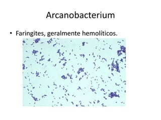ArcanobacteriumFaringites, geralmente hemolíticos.
