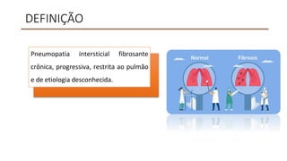 DEFINIÇÃO
Pneumopatia intersticial fibrosante
crônica, progressiva, restrita ao pulmão
e de etiologia desconhecida.
 