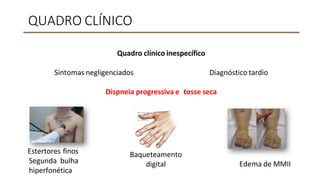 QUADRO CLÍNICO
Quadro clínico inespecífico
Sintomas negligenciados Diagnóstico tardio
Dispneia progressiva e tosse seca
Estertores finos
Segunda bulha
hiperfonética
Baqueteamento
digital Edema de MMII
 