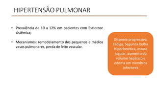 HIPERTENSÃO PULMONAR
• Prevalência de 10 a 12% em pacientes com Esclerose
sistêmica;
• Mecanismos: remodelamento dos pequenos e médios
vasos pulmonares, perda de leito vascular.
Dispneia progressiva,
fadiga, Segunda bulha
Hiperfonética, estase
jugular, aumento do
volume hepático e
edema em membros
inferiores
 