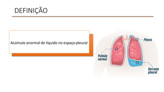 DEFINIÇÃO
Acúmulo anormal de líquido no espaço pleural
 