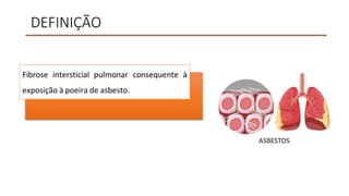 DEFINIÇÃO
Fibrose intersticial pulmonar consequente à
exposição à poeira de asbesto.
 