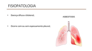 FISIOPATOLOGIA
• Doença difusa e bilateral;
• Ocorre com ou sem espessamento pleural;
 