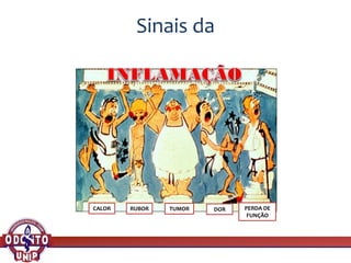 Sinais da
CALOR RUBOR TUMOR DOR PERDA DE
FUNÇÃO
 