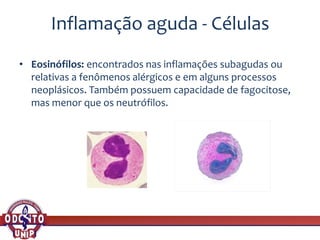Inflamação aguda - Células
• Eosinófilos: encontrados nas inflamações subagudas ou
relativas a fenômenos alérgicos e em alguns processos
neoplásicos. Também possuem capacidade de fagocitose,
mas menor que os neutrófilos.
 