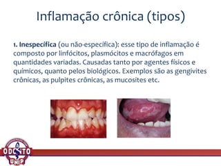 Inflamação crônica (tipos)
1. Inespecífica (ou não-específica): esse tipo de inflamação é
composto por linfócitos, plasmócitos e macrófagos em
quantidades variadas. Causadas tanto por agentes físicos e
químicos, quanto pelos biológicos. Exemplos são as gengivites
crônicas, as pulpites crônicas, as mucosites etc.
 