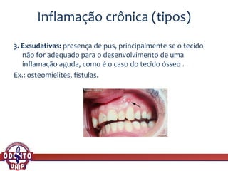 Inflamação crônica (tipos)
3. Exsudativas: presença de pus, principalmente se o tecido
não for adequado para o desenvolvimento de uma
inflamação aguda, como é o caso do tecido ósseo .
Ex.: osteomielites, fístulas.
 