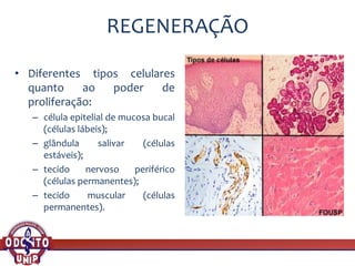 REGENERAÇÃO
• Diferentes tipos celulares
quanto ao poder de
proliferação:
– célula epitelial de mucosa bucal
(células lábeis);
– glândula salivar (células
estáveis);
– tecido nervoso periférico
(células permanentes);
– tecido muscular (células
permanentes).
 