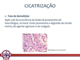 CICATRIZAÇÃO
1. Fase de demolição:
Após 24h da ocorrência da lesão há predomínio de
macrófagos, no local. Estes promovem a digestão do tecido
morto, do agente agressor e do coágulo
Macrófagos em um granuloma
 