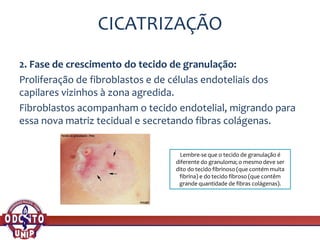 CICATRIZAÇÃO
2. Fase de crescimento do tecido de granulação:
Proliferação de fibroblastos e de células endoteliais dos
capilares vizinhos à zona agredida.
Fibroblastos acompanham o tecido endotelial, migrando para
essa nova matriz tecidual e secretando fibras colágenas.
Lembre-se que o tecido de granulação é
diferente do granuloma; o mesmo deve ser
dito do tecido fibrinoso (que contém muita
fibrina) e do tecido fibroso (que contêm
grande quantidade de fibras colágenas).
 