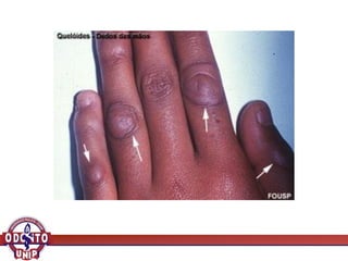 AULA 6 - Inflamação II.pdf