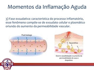 Momentos da Inflamação Aguda
3) Fase exsudativa: característica do processo inflamatório,
esse fenômeno compõe-se de exsudato celular e plasmático
oriundo do aumento da permeabilidade vascular.
Ocorre vasodilatação e aumento da
permeabilidade do vaso e
diapedese.
 