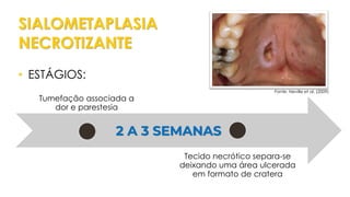 SIALOMETAPLASIA
NECROTIZANTE
Tumefação associada a
dor e parestesia
Tecido necrótico separa-se
deixando uma área ulcerada
em formato de cratera
• ESTÁGIOS:
2 A 3 SEMANAS
Fonte: Neville et al. (2009)
 