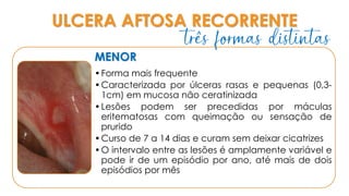ULCERA AFTOSA RECORRENTE
MENOR
•Forma mais frequente
•Caracterizada por úlceras rasas e pequenas (0,3-
1cm) em mucosa não ceratinizada
•Lesões podem ser precedidas por máculas
eritematosas com queimação ou sensação de
prurido
•Curso de 7 a 14 dias e curam sem deixar cicatrizes
•O intervalo entre as lesões é amplamente variável e
pode ir de um episódio por ano, até mais de dois
episódios por mês
três formas distintas
 