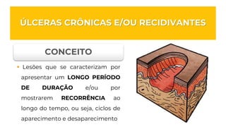 ÚLCERAS CRÔNICAS E/OU RECIDIVANTES
CONCEITO
▪ Lesões que se caracterizam por
apresentar um LONGO PERÍODO
DE DURAÇÃO e/ou por
mostrarem RECORRÊNCIA ao
longo do tempo, ou seja, ciclos de
aparecimento e desaparecimento
 