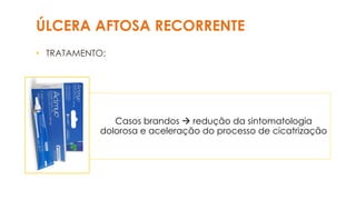ÚLCERA AFTOSA RECORRENTE
• TRATAMENTO:
Casos brandos → redução da sintomatologia
dolorosa e aceleração do processo de cicatrização
 