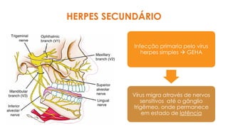 HERPES SECUNDÁRIO
Infecção primaria pelo vírus
herpes simples → GEHA
Vírus migra através de nervos
sensitivos até o gânglio
trigêmeo, onde permanece
em estado de latência
 