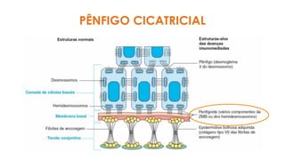 PÊNFIGO CICATRICIAL
 