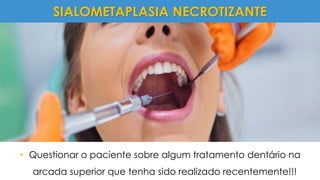 • Questionar o paciente sobre algum tratamento dentário na
arcada superior que tenha sido realizado recentemente!!!
SIALOMETAPLASIA NECROTIZANTE
 