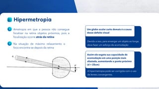 44
Público
Ametropia em que a pessoa não consegue
focalizar na retina objetos próximos, pois a
focalização ocorre atrás da retina
Na situação de máximo relaxamento o
foco encontra-se depois da retina
Devido a isso, para enxergar um objeto ao longe,
deve fazer um esforço de acomodação
Um globo ocular curto demais é a causa
desse defeito visual
A hipermetropia pode ser corrigida com o uso
de lentes convergentes.
Assim ele esgota sua capacidade de
acomodação em uma posição mais
afastada, aumentando o ponto próximo
(d > 25cm)
 