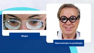 48
Miopia
Hipermetropia ou presbiopia
 