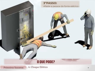 Aula 6 Primeiros Socorros Choque El trico pdf aula-6-primeiros-socorros-choque-el-trico-pdf