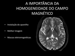 • Instalação do aparelho
• Melhor imagem
• Massas eletromagnéticas
A IMPORTÂNCIA DA
HOMOGENEIDADE DO CAMPO
MAGNÉTICO
 