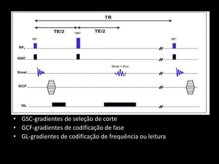 • GSC-gradientes de seleção de corte
• GCF-gradientes de codificação de fase
• GL-gradientes de codificação de frequência ou leitura
 