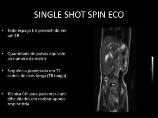 • Todo espaço k é preenchido em
um TR
• Quantidade de pulsos equivale
ao número da matriz
• Sequência ponderada em T2-
cadeia de ecos longa (TR longo).
• Técnica útil para pacientes com
dificuldades em realizar apneia
respiratória
SINGLE SHOT SPIN ECO
 