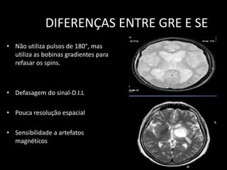 • Não utiliza pulsos de 180°, mas
utiliza as bobinas gradientes para
refasar os spins.
• Defasagem do sinal-D.I.L
• Pouca resolução espacial
• Sensibilidade a artefatos
magnéticos
DIFERENÇAS ENTRE GRE E SE
 