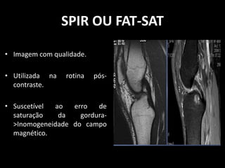 • Imagem com qualidade.
• Utilizada na rotina pós-
contraste.
• Suscetível ao erro de
saturação da gordura-
>Inomogeneidade do campo
magnético.
SPIR OU FAT-SAT
 