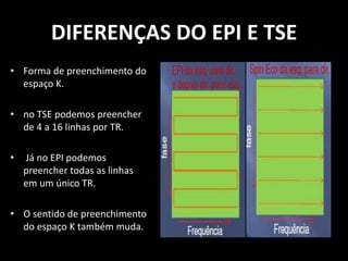 • Forma de preenchimento do
espaço K.
• no TSE podemos preencher
de 4 a 16 linhas por TR.
• Já no EPI podemos
preencher todas as linhas
em um único TR.
• O sentido de preenchimento
do espaço K também muda.
DIFERENÇAS DO EPI E TSE
 