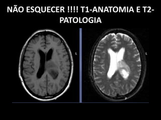 NÃO ESQUECER !!!! T1-ANATOMIA E T2-
PATOLOGIA
 
