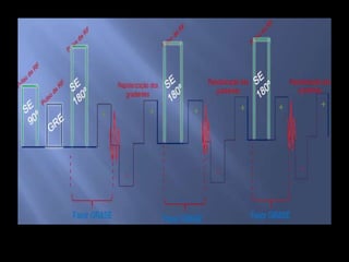 SEQUÊNCIAS DE PULSO NA RM