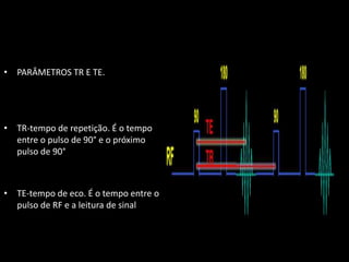 • PARÂMETROS TR E TE.
• TR-tempo de repetição. É o tempo
entre o pulso de 90° e o próximo
pulso de 90°
• TE-tempo de eco. É o tempo entre o
pulso de RF e a leitura de sinal
 