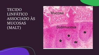 TECIDO
LINFÁTICO
ASSOCIADO ÀS
MUCOSAS
(MALT)
 