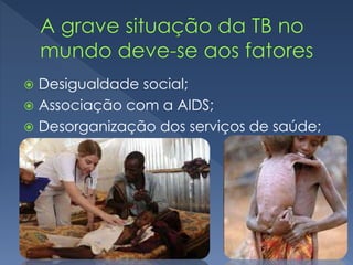  Desigualdade social;
 Associação com a AIDS;
 Desorganização dos serviços de saúde;
 