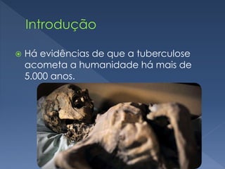  Há evidências de que a tuberculose
acometa a humanidade há mais de
5.000 anos.
 