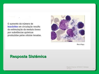 Magda Charrua  2010/2011 Biologia 12º ano  Resposta Sistémica 